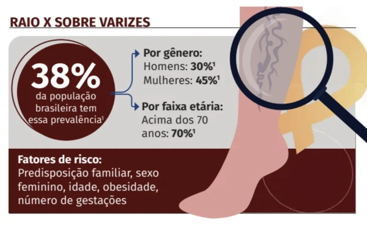 Uma rotina de autocuidado para as varizes