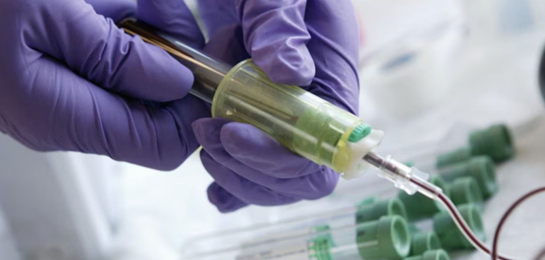 Leucemia linfoblástica aguda: diagnóstico, desafios e avanços no tratamento