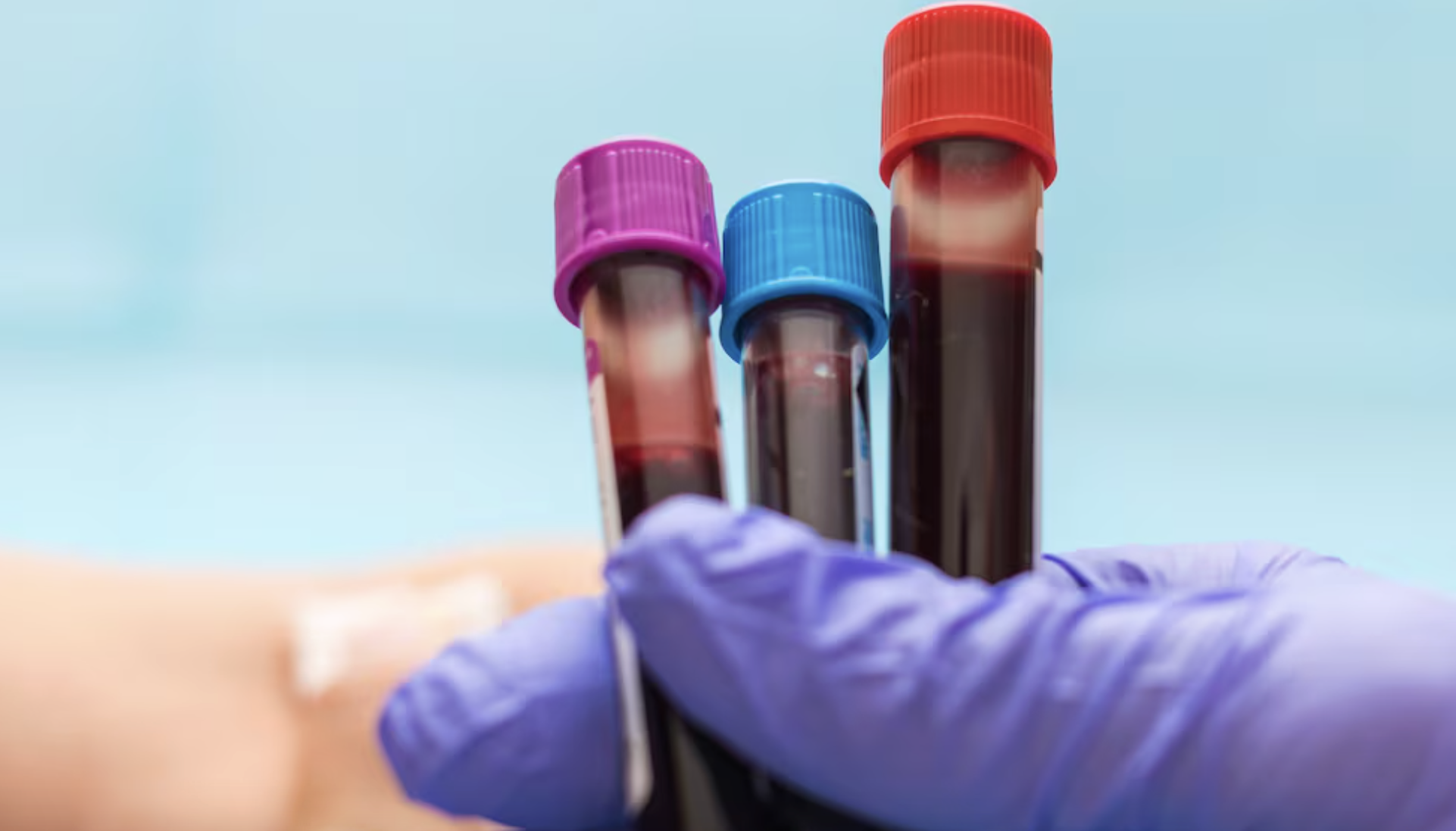 Compatibilidade sanguínea vai muito além dos tipos A, B, AB e O
